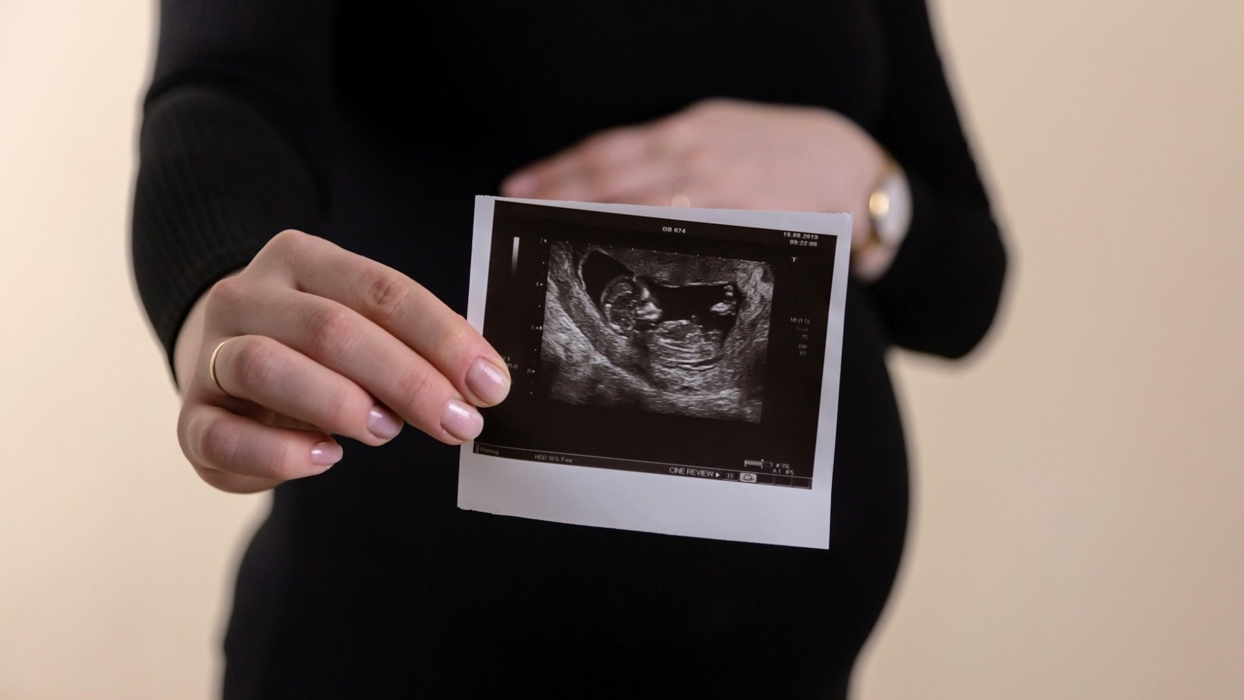 Trump’s IVF Policy, a New Statement on Superintelligence, and the NBA Betting Scandal