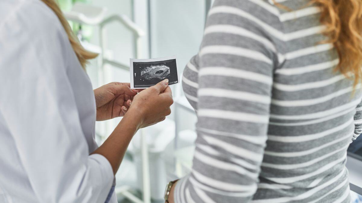 The Self-Organizing Human Embryo